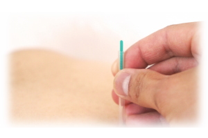 鷹匠鍼灸院,鍼灸,鍼（はり）,灸（きゅう）,マッサージ